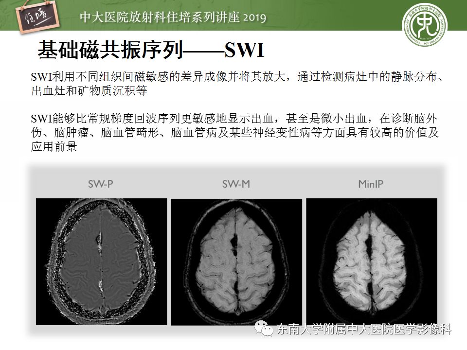 【PPT】从临床应用操作解析磁共振序列