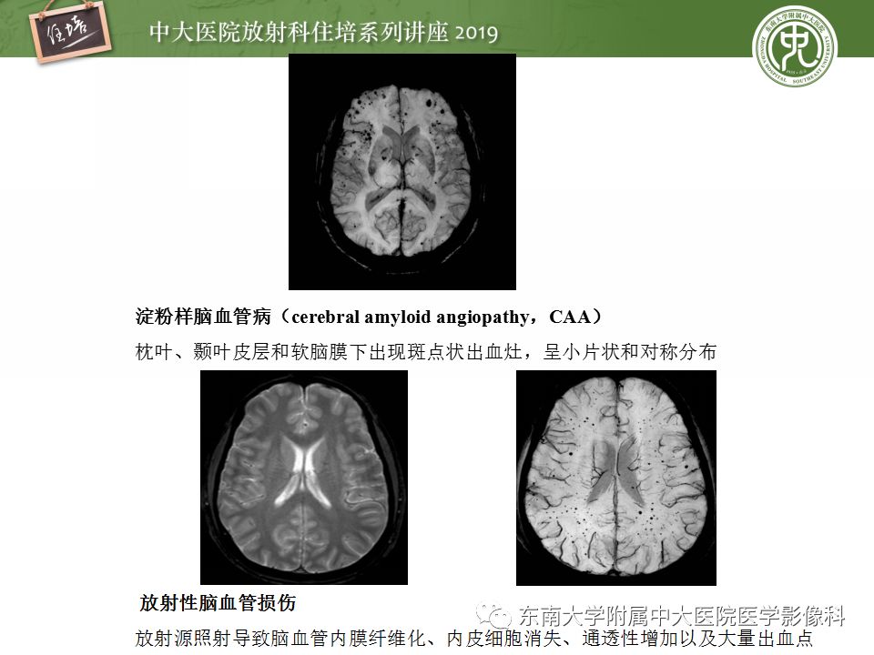 【PPT】从临床应用操作解析磁共振序列
