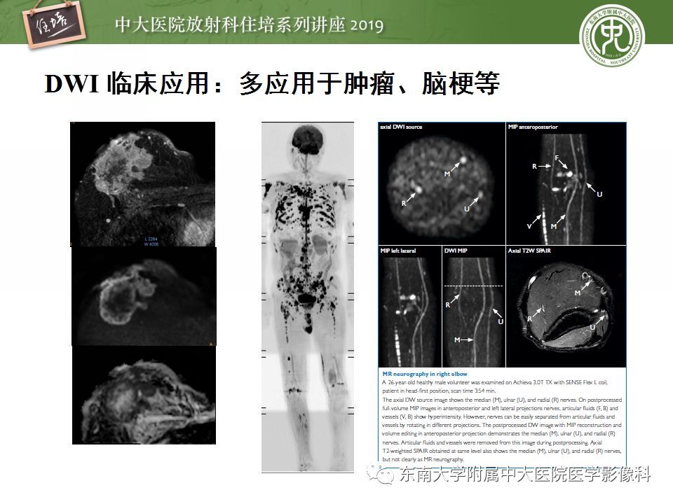 【PPT】从临床应用操作解析磁共振序列
