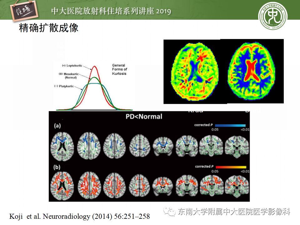 【PPT】从临床应用操作解析磁共振序列