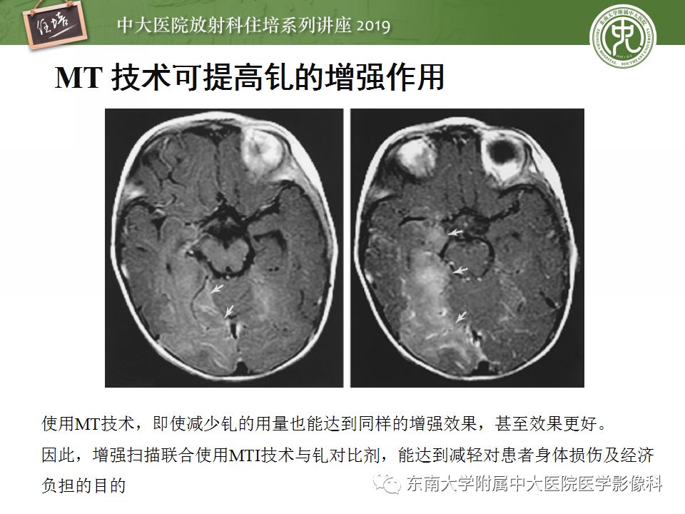 【PPT】从临床应用操作解析磁共振序列