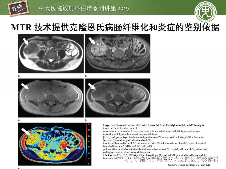 【PPT】从临床应用操作解析磁共振序列