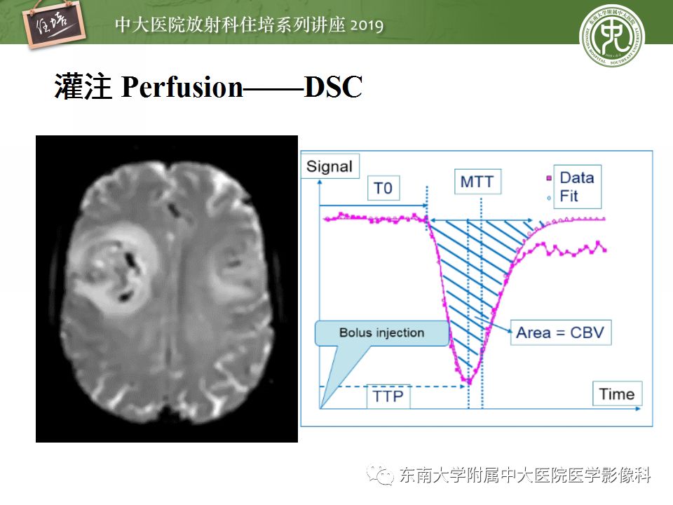 【PPT】从临床应用操作解析磁共振序列