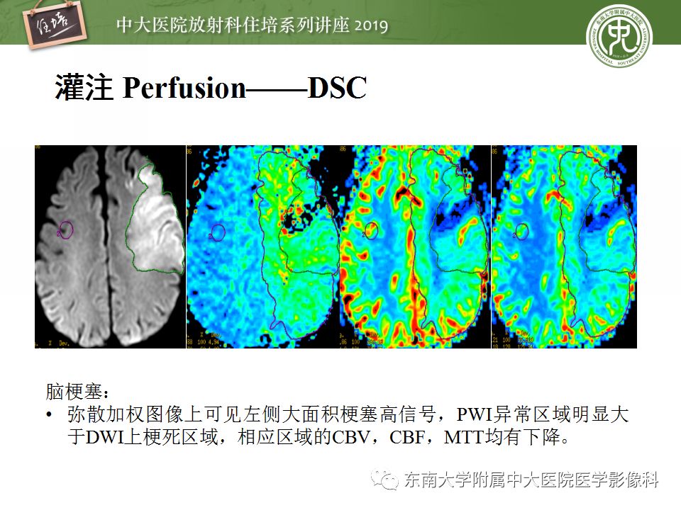 【PPT】从临床应用操作解析磁共振序列