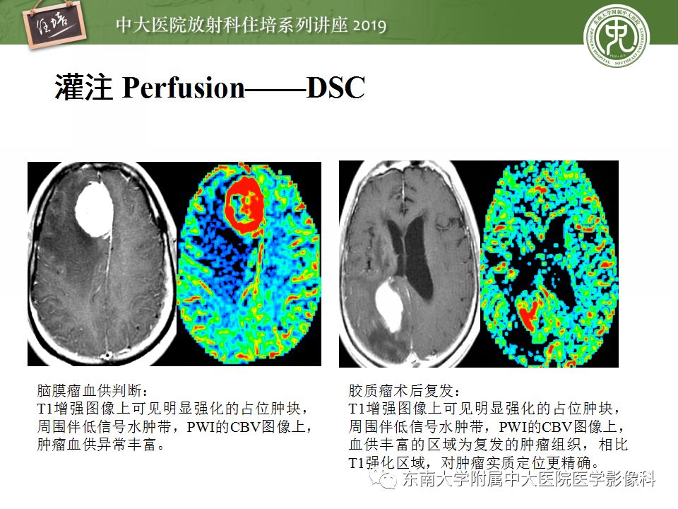 【PPT】从临床应用操作解析磁共振序列