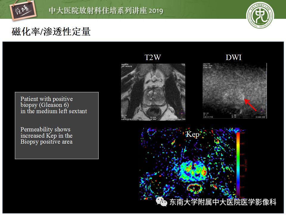 【PPT】从临床应用操作解析磁共振序列