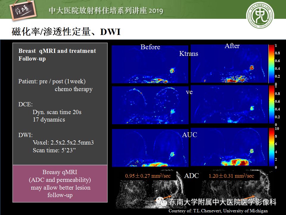 【PPT】从临床应用操作解析磁共振序列