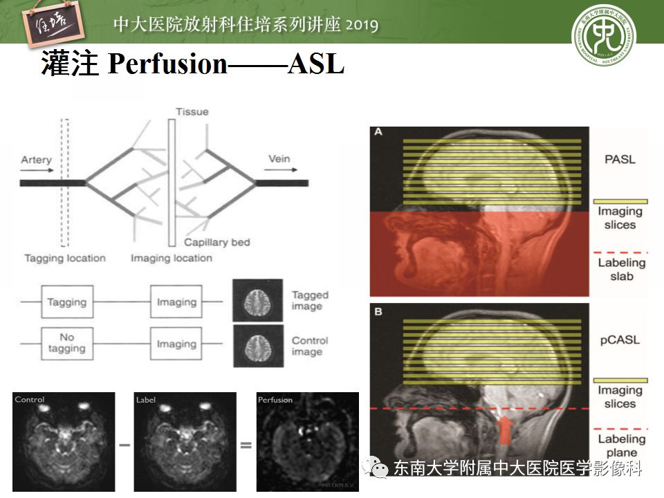 【PPT】从临床应用操作解析磁共振序列