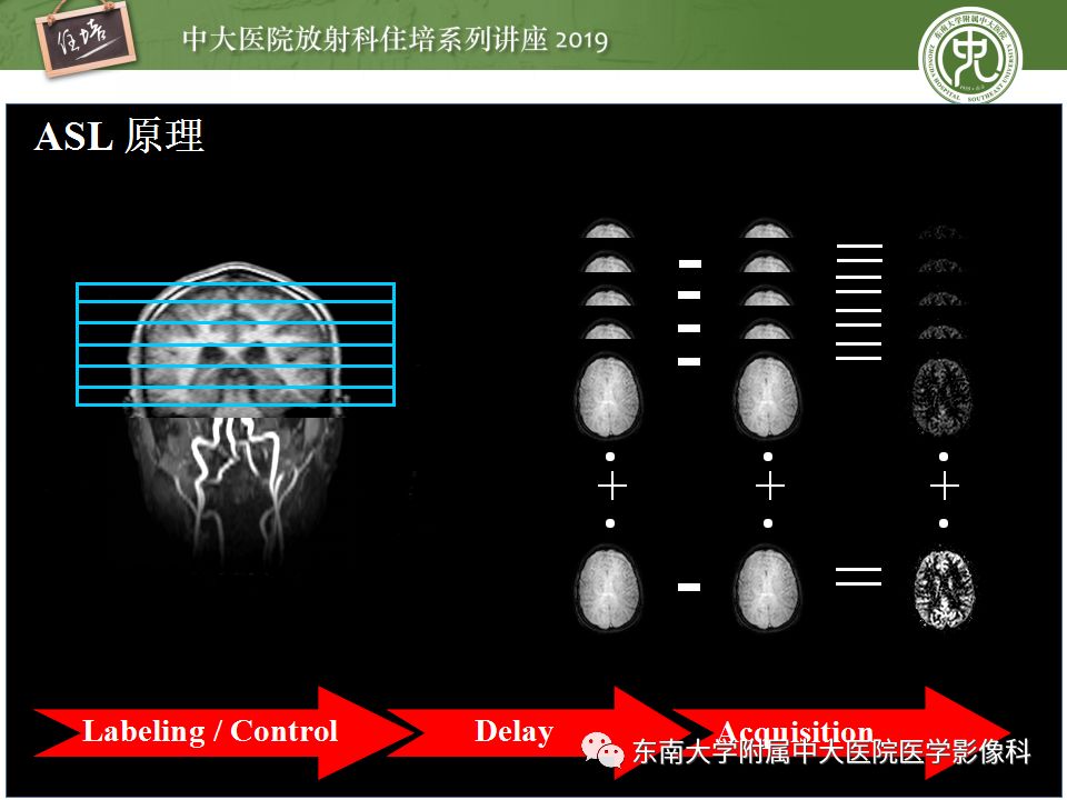 【PPT】从临床应用操作解析磁共振序列