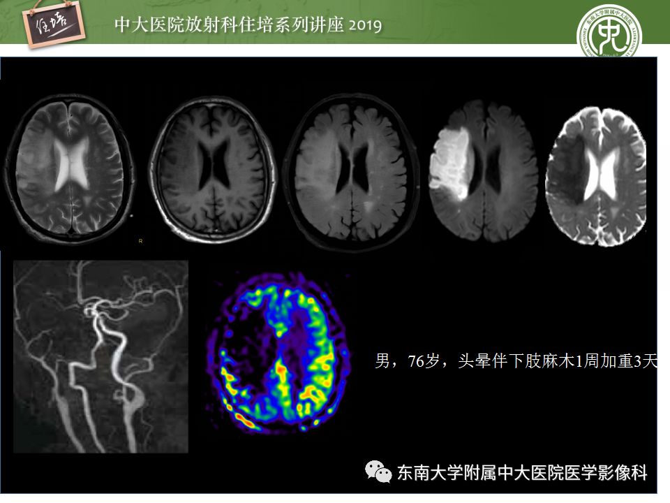 【PPT】从临床应用操作解析磁共振序列