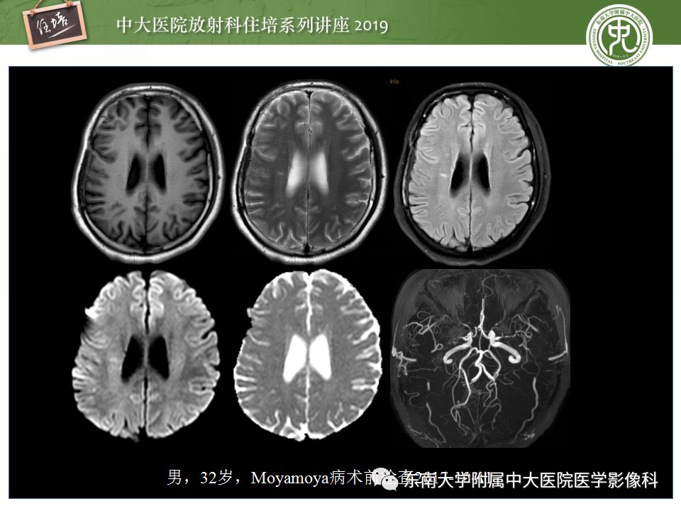 【PPT】从临床应用操作解析磁共振序列