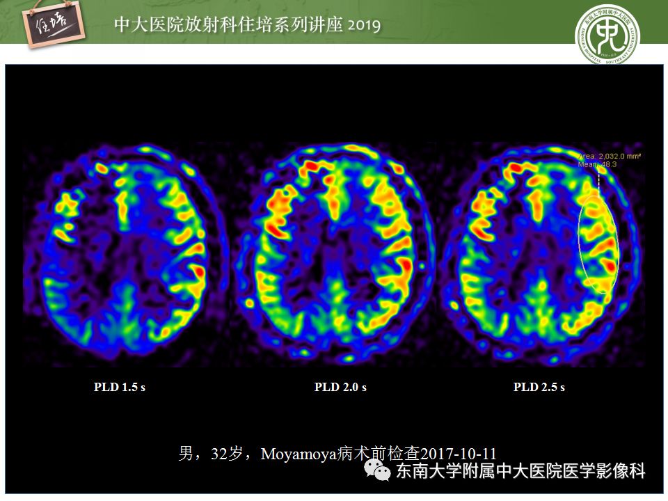 【PPT】从临床应用操作解析磁共振序列