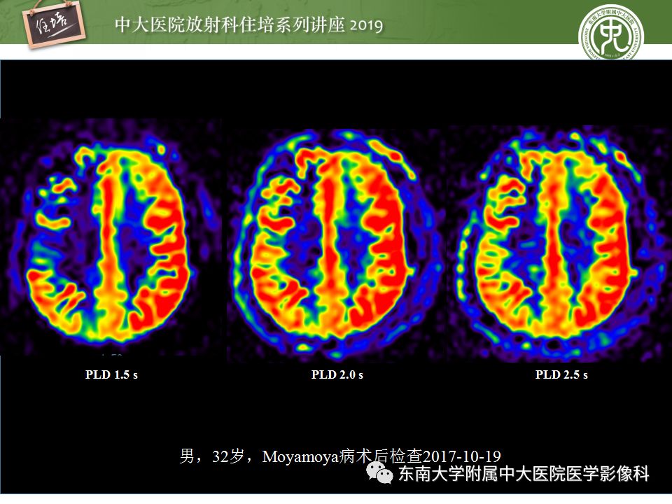 【PPT】从临床应用操作解析磁共振序列
