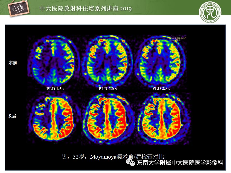 【PPT】从临床应用操作解析磁共振序列