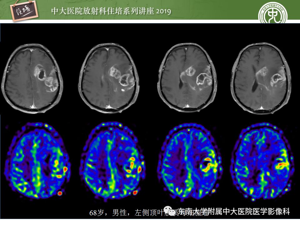 【PPT】从临床应用操作解析磁共振序列