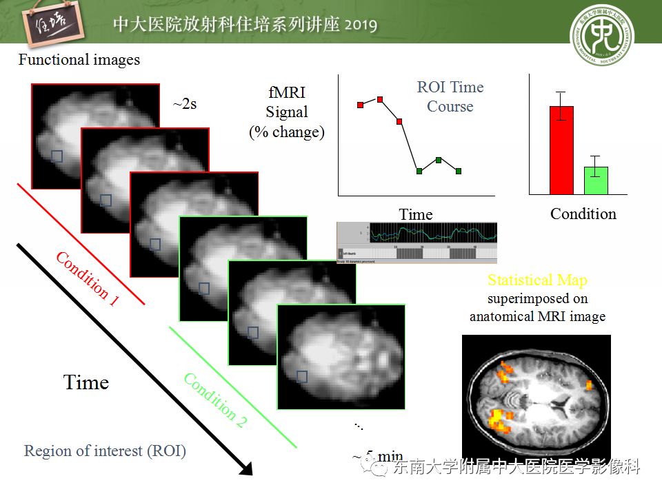 【PPT】从临床应用操作解析磁共振序列