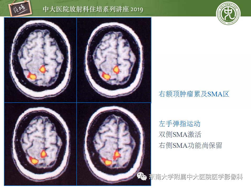 【PPT】从临床应用操作解析磁共振序列