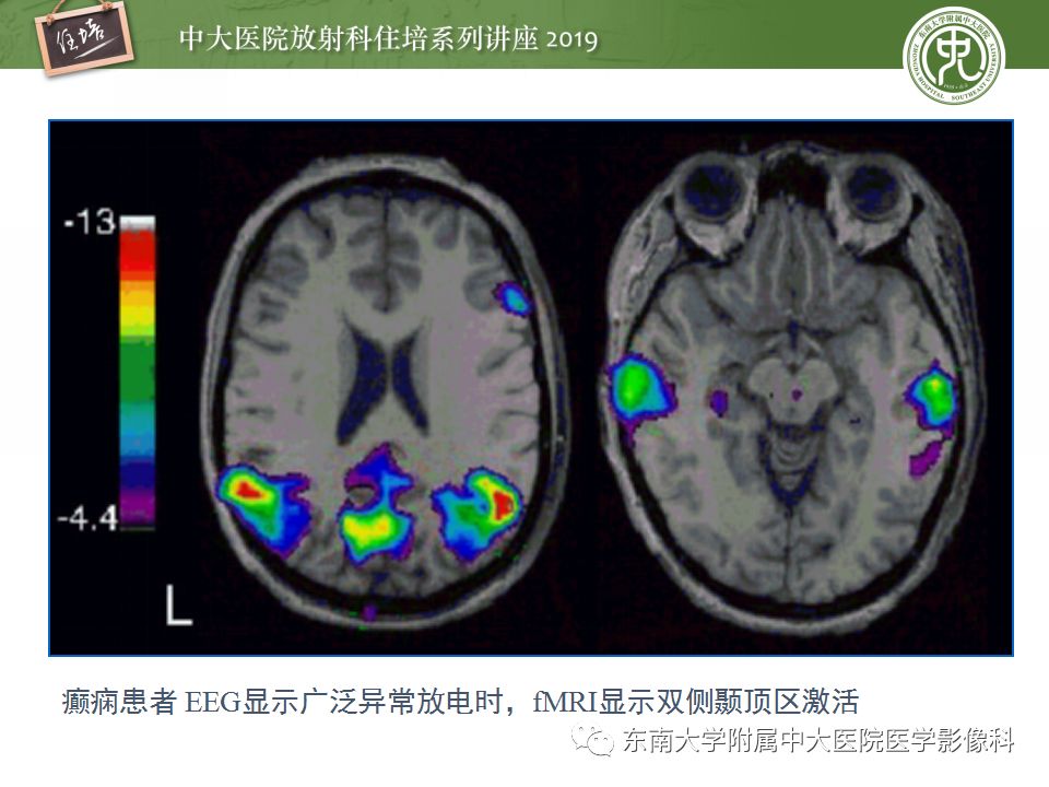 【PPT】从临床应用操作解析磁共振序列