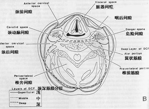 颈部解剖与常见疾病的影像特点 颈部解剖与常见疾病的影像特点