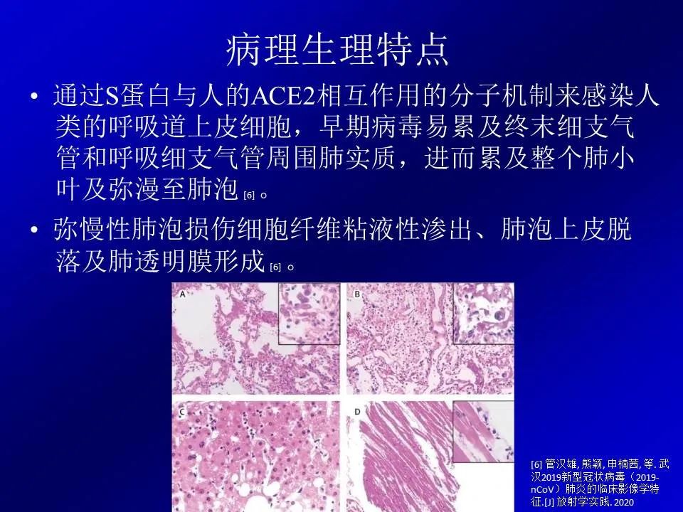【PPT】新型冠状病毒肺炎影像学诊断及鉴别诊断