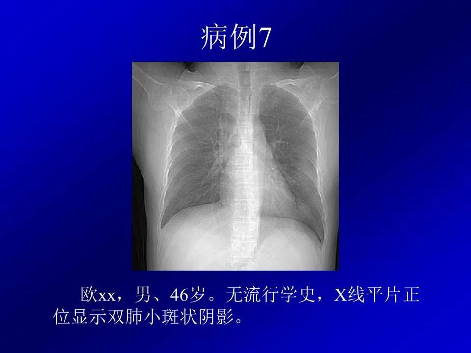 【PPT】新型冠状病毒肺炎影像学诊断及鉴别诊断