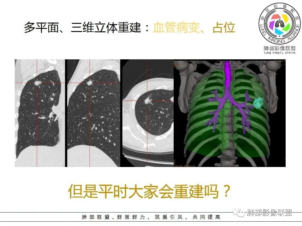 【PPT】如何快速掌握新冠肺炎(NCP)的影像识别? 【PPT】如何快速掌握新冠肺炎(NCP)的影像识别?