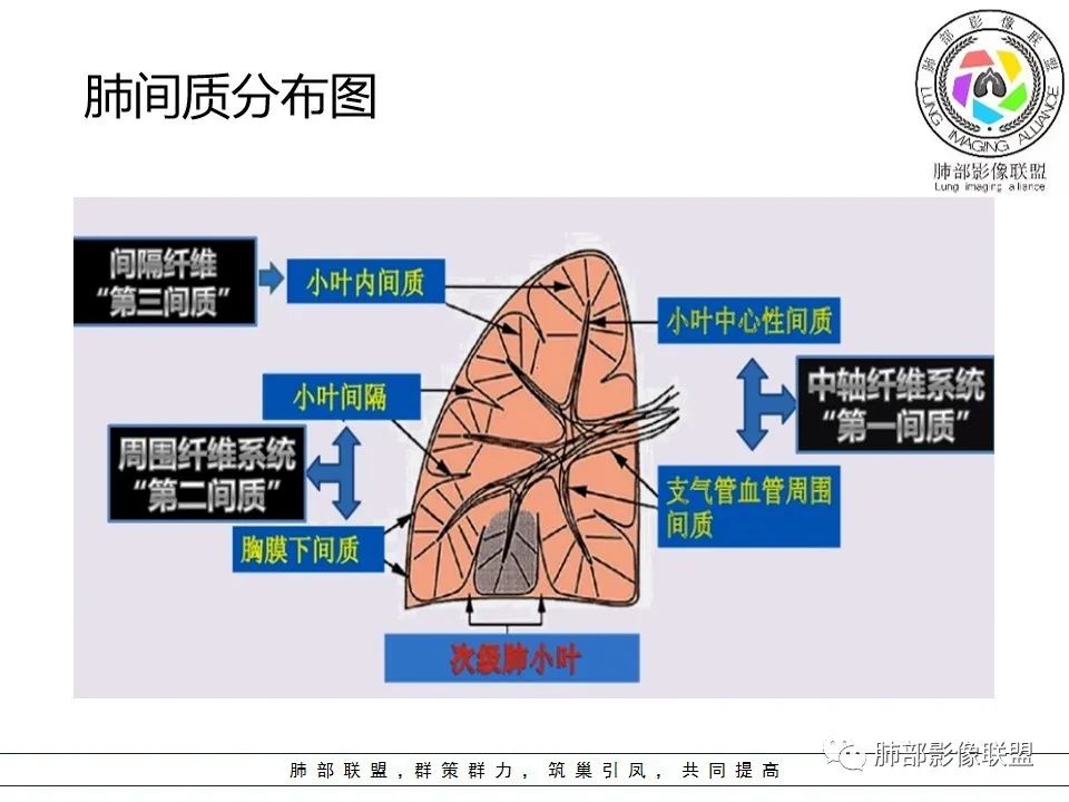 【PPT】如何快速掌握新冠肺炎(NCP)的影像识别? 【PPT】如何快速掌握新冠肺炎(NCP)的影像识别?