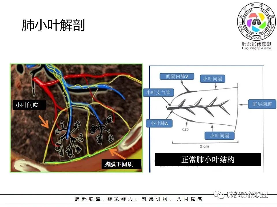 【PPT】如何快速掌握新冠肺炎(NCP)的影像识别? 【PPT】如何快速掌握新冠肺炎(NCP)的影像识别?