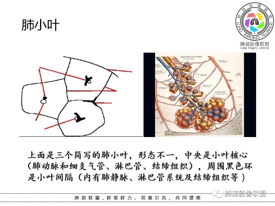 【PPT】如何快速掌握新冠肺炎(NCP)的影像识别? 【PPT】如何快速掌握新冠肺炎(NCP)的影像识别?