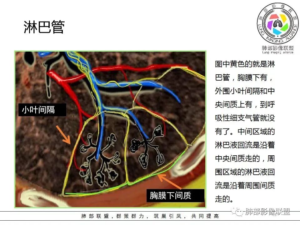 【PPT】如何快速掌握新冠肺炎(NCP)的影像识别? 【PPT】如何快速掌握新冠肺炎(NCP)的影像识别?