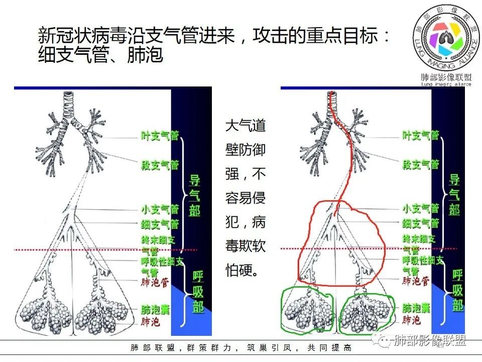 【PPT】如何快速掌握新冠肺炎(NCP)的影像识别? 【PPT】如何快速掌握新冠肺炎(NCP)的影像识别?