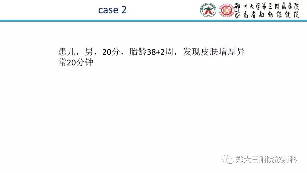 【PPT】婴儿型肝脏血管内皮瘤的影像