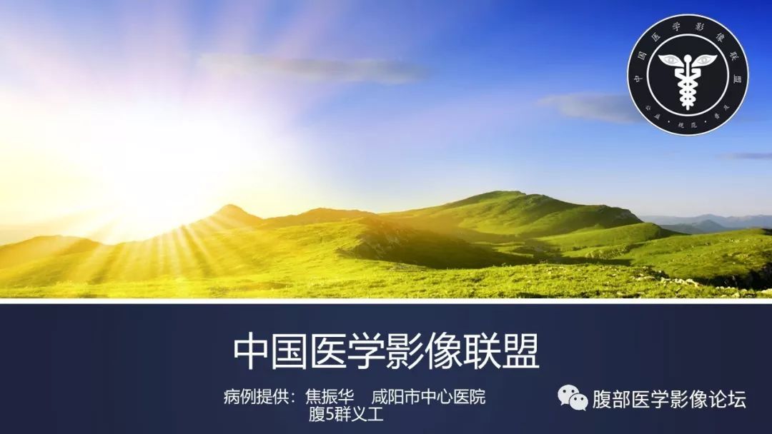 【病例】卵巢癌肉瘤1例MR影像