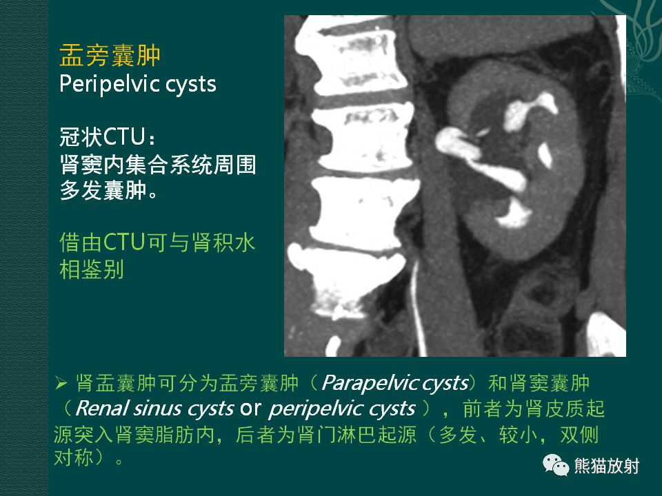 【PPT】肾脏囊性病变的CT及MRI表现
