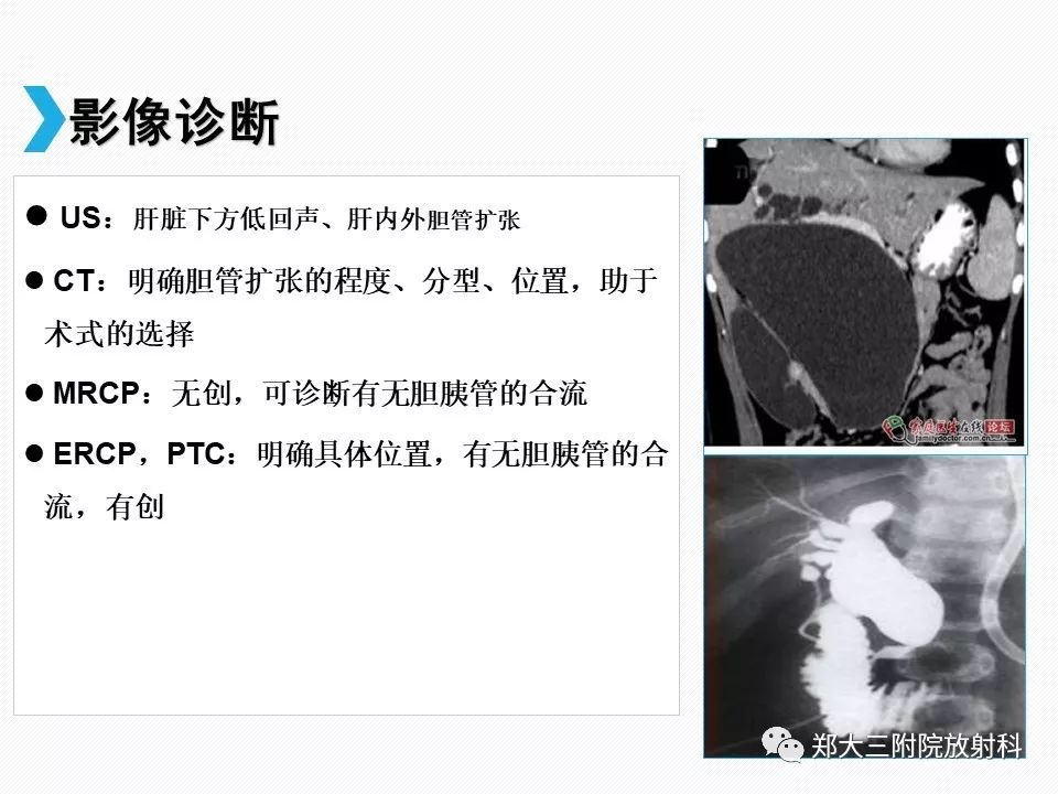 【PPT】小儿先天性胆总管囊肿CT诊断