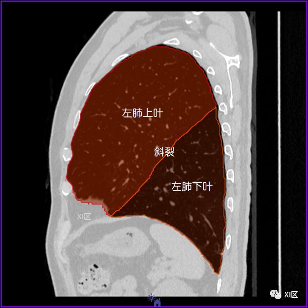 肺部影像解剖 肺部影像解剖