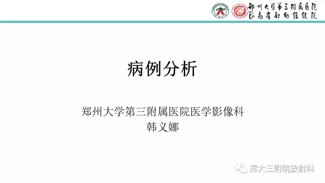 【病例】儿童胫腓骨骨纤维结构不良1例X线CT及MR影像