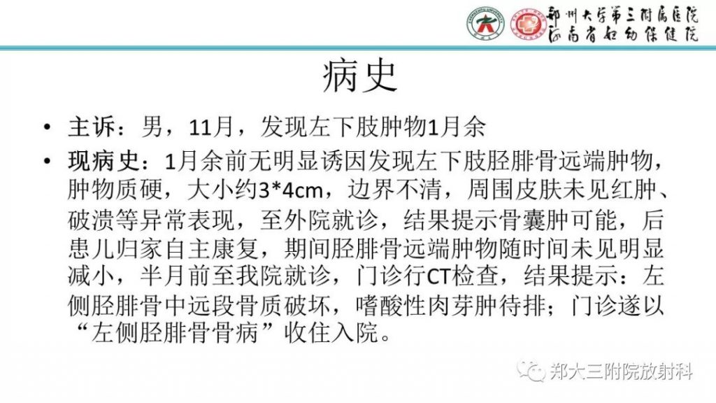 【病例】儿童胫腓骨骨纤维结构不良1例X线CT及MR影像