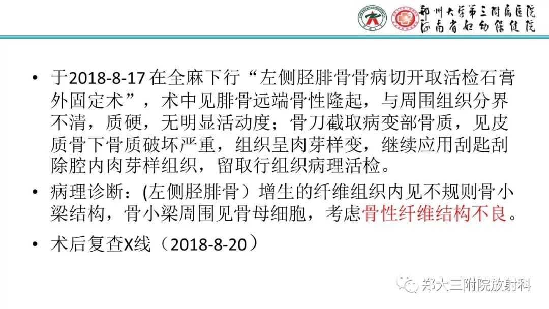 【病例】儿童胫腓骨骨纤维结构不良1例X线CT及MR影像