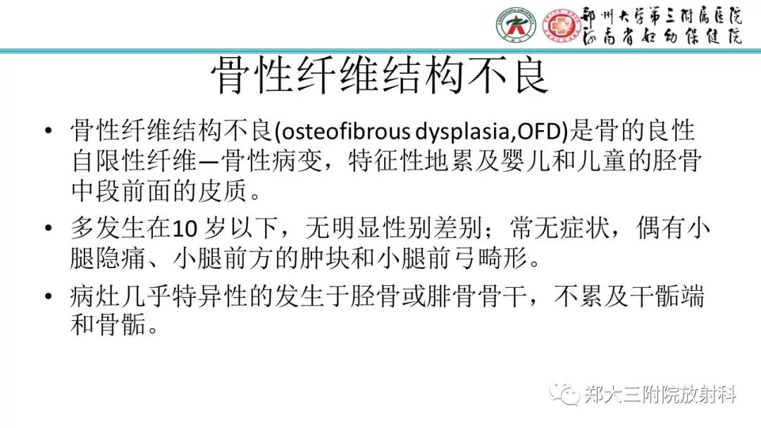 【病例】儿童胫腓骨骨纤维结构不良1例X线CT及MR影像