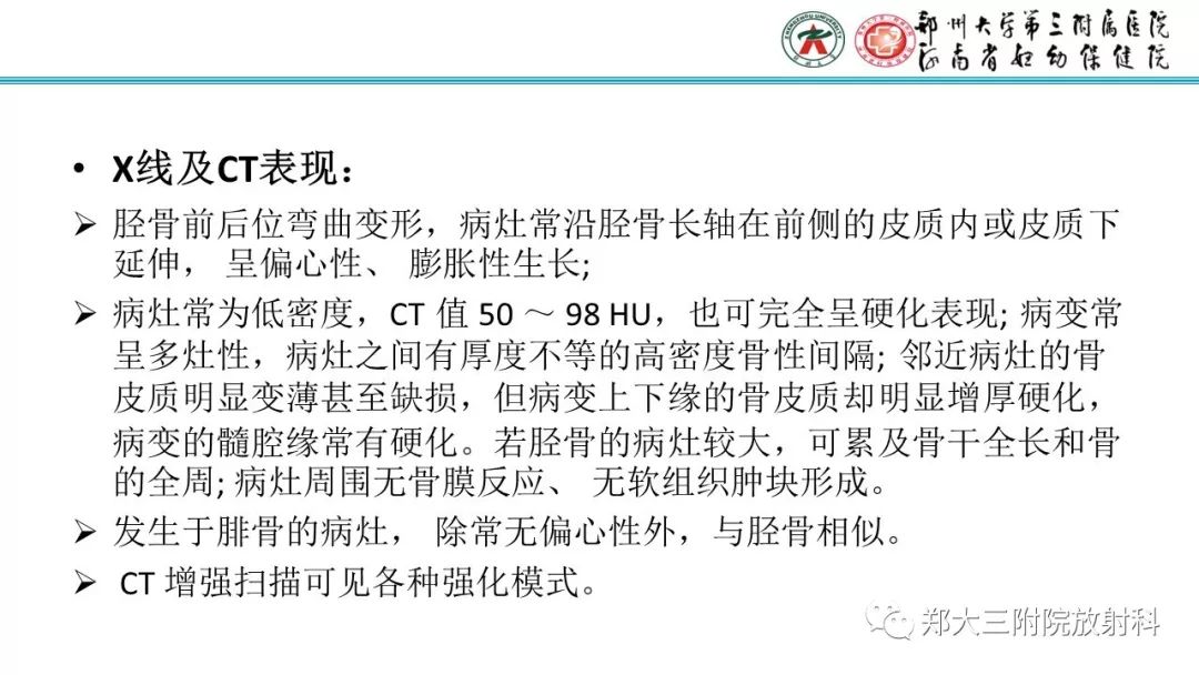 【病例】儿童胫腓骨骨纤维结构不良1例X线CT及MR影像