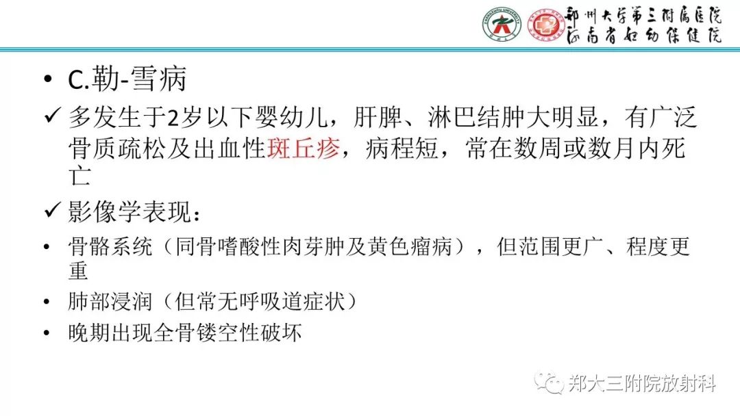 【病例】儿童胫腓骨骨纤维结构不良1例X线CT及MR影像