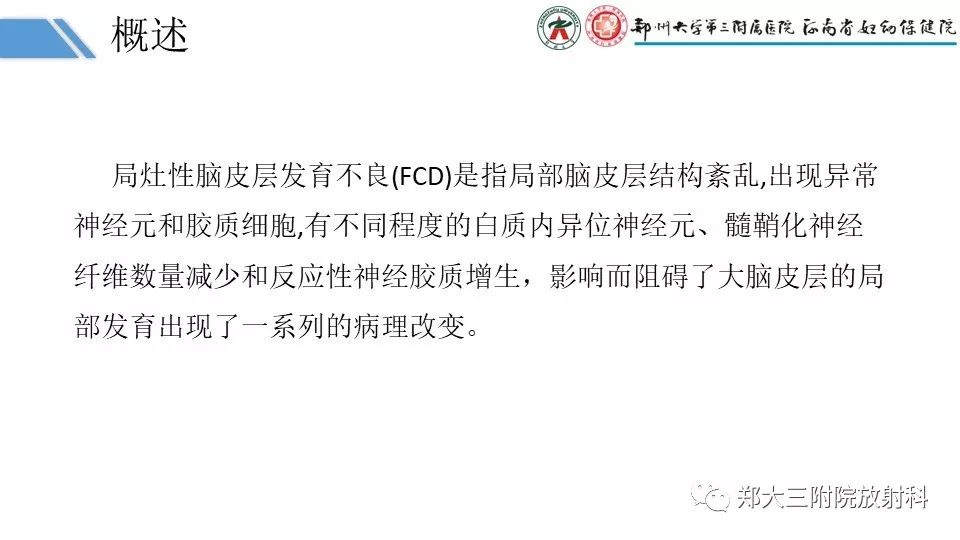 【PPT】局灶性脑皮层发育不良（FCD）