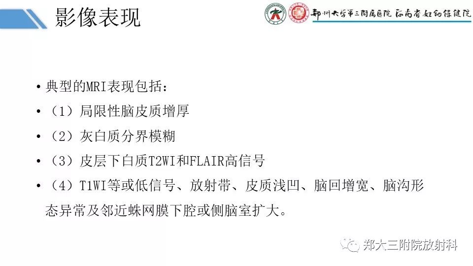 【PPT】局灶性脑皮层发育不良（FCD）