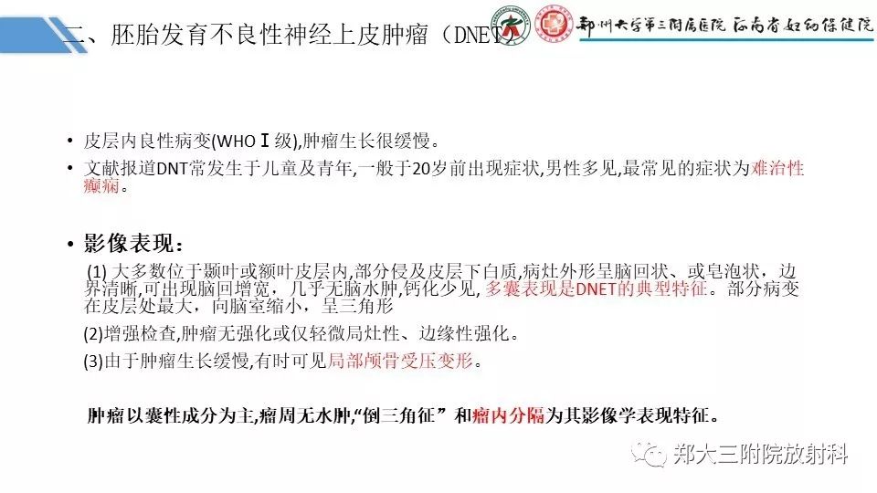 【PPT】局灶性脑皮层发育不良（FCD）