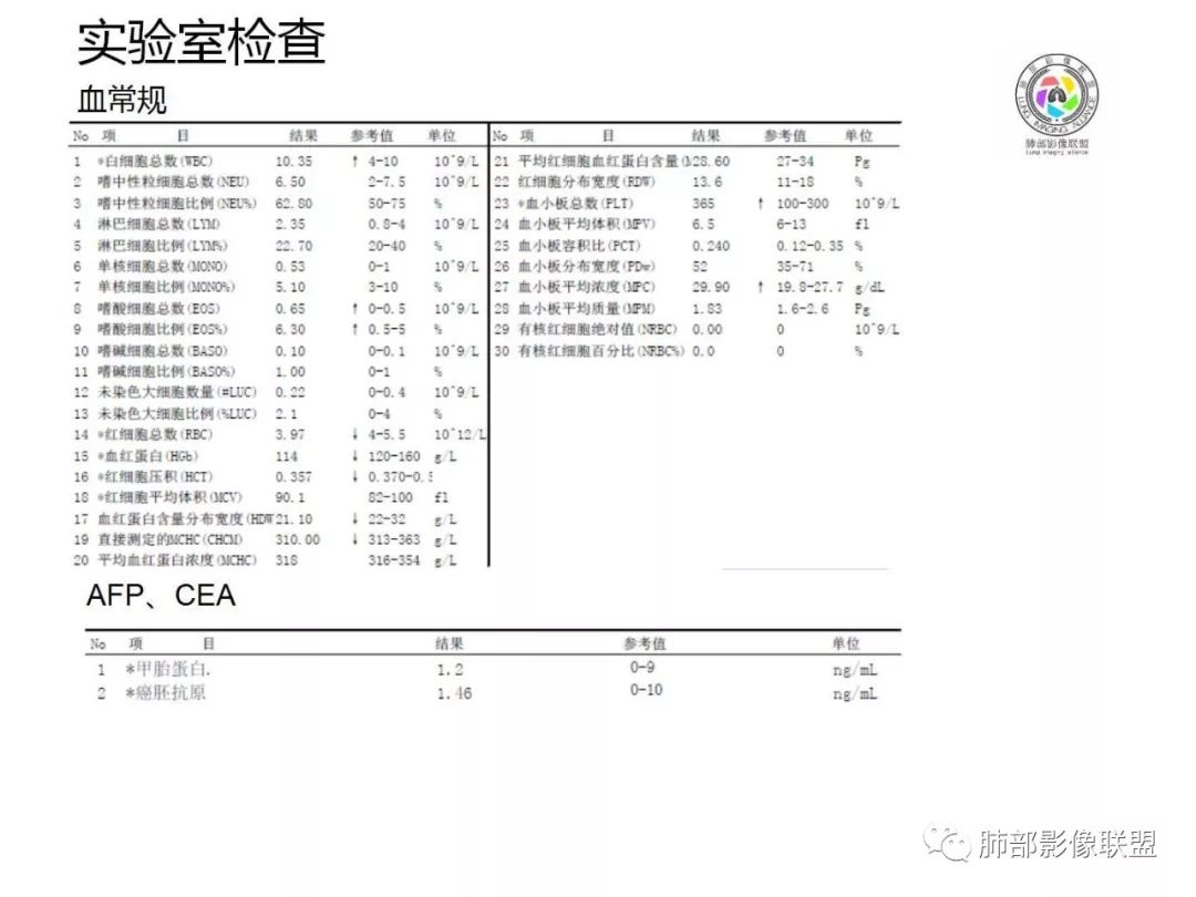 【病例】妖魔合体—你想不到的肉瘤样癌 【病例】妖魔合体—你想不到的肉瘤样癌