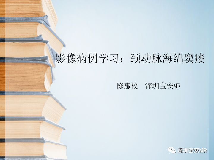 【病例】颈动脉海绵窦瘘3例CT及MR影像