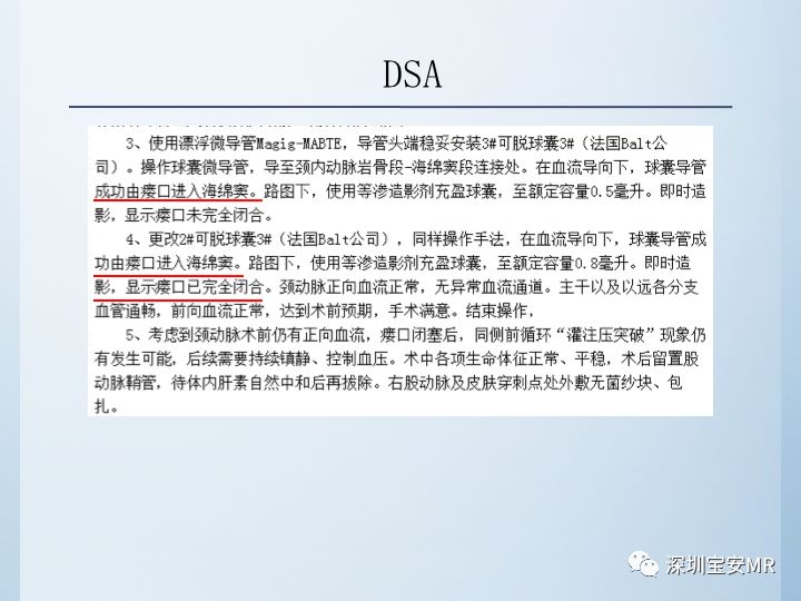 【病例】颈动脉海绵窦瘘3例CT及MR影像