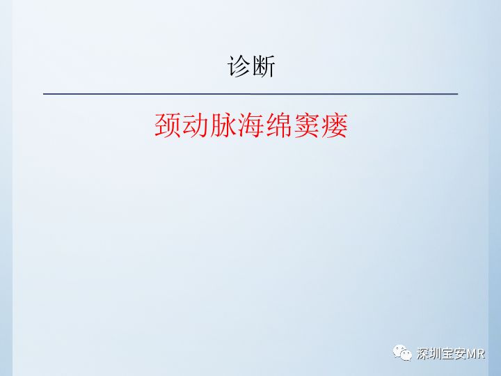 【病例】颈动脉海绵窦瘘3例CT及MR影像