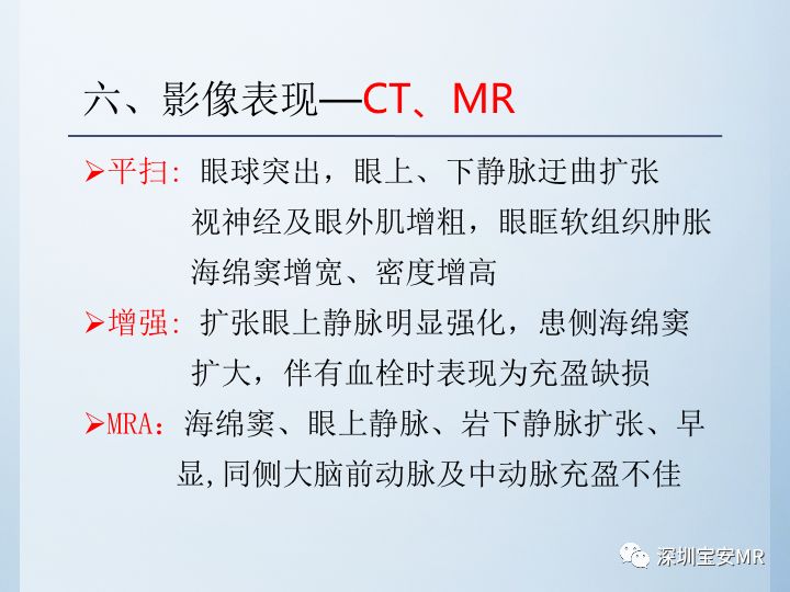 【病例】颈动脉海绵窦瘘3例CT及MR影像